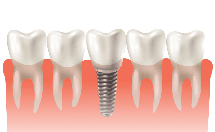 Emergency Dentist Midtown
