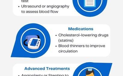 Step-by-Step Guide to PAD Treatment Step-by-Step Guide to PAD Treatment